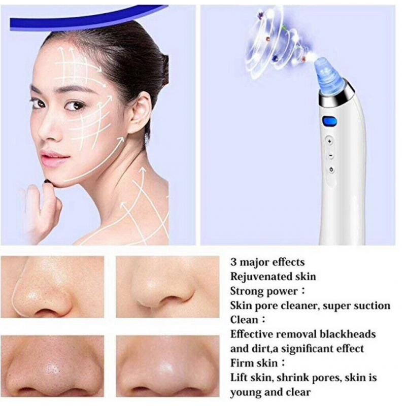 Blackhead Remover Vacuum Pore Cleaner Electric Acne Comedone Extractor Kit